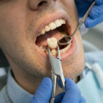Our Dental Services in Stoke on Trent | Dentist in Stoke on Trent