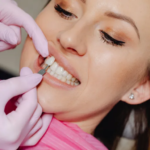 Our Dental Services in Stoke on Trent | Dentist in Stoke on Trent