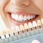 Our Dental Services in Stoke on Trent | Dentist in Stoke on Trent